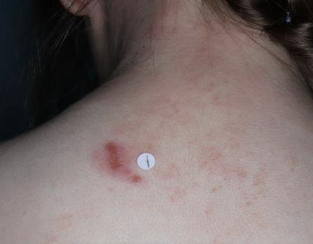 Baseline