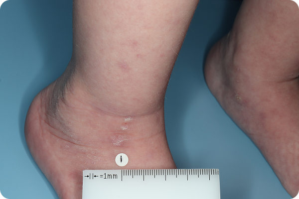 HAND-AD-2-1