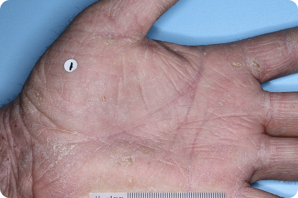 HAND-AD-2-5