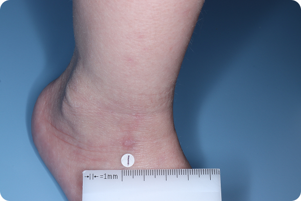 HAND-AD-3-1