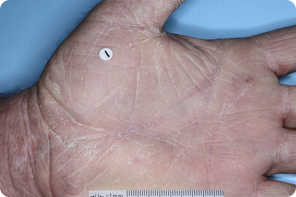 HAND-AD-3-5